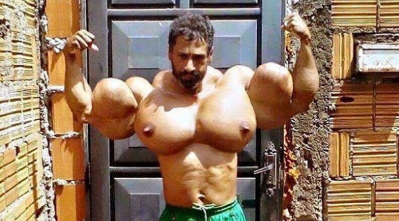 Bodybuilder Blows Arms Out With Oil Injections   Synthol Pecs Guy 800x443 