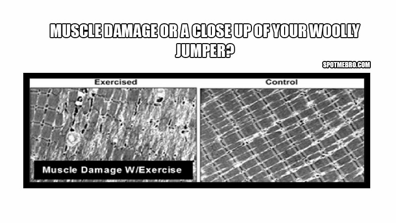 Muscle hypertrophy damage MRI scan