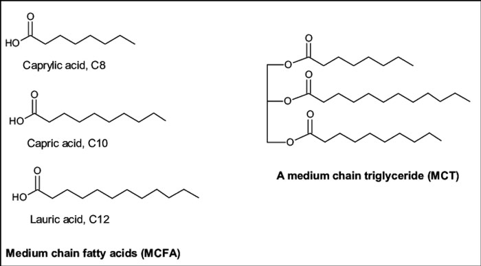 Example of MCT