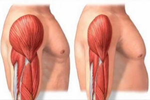 loss of lean muscle man due to protein deficiency