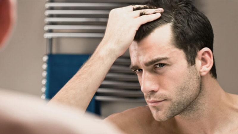 Man looking into the mirror to check hair loss due testosterone